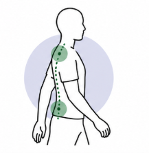 Posture Correction